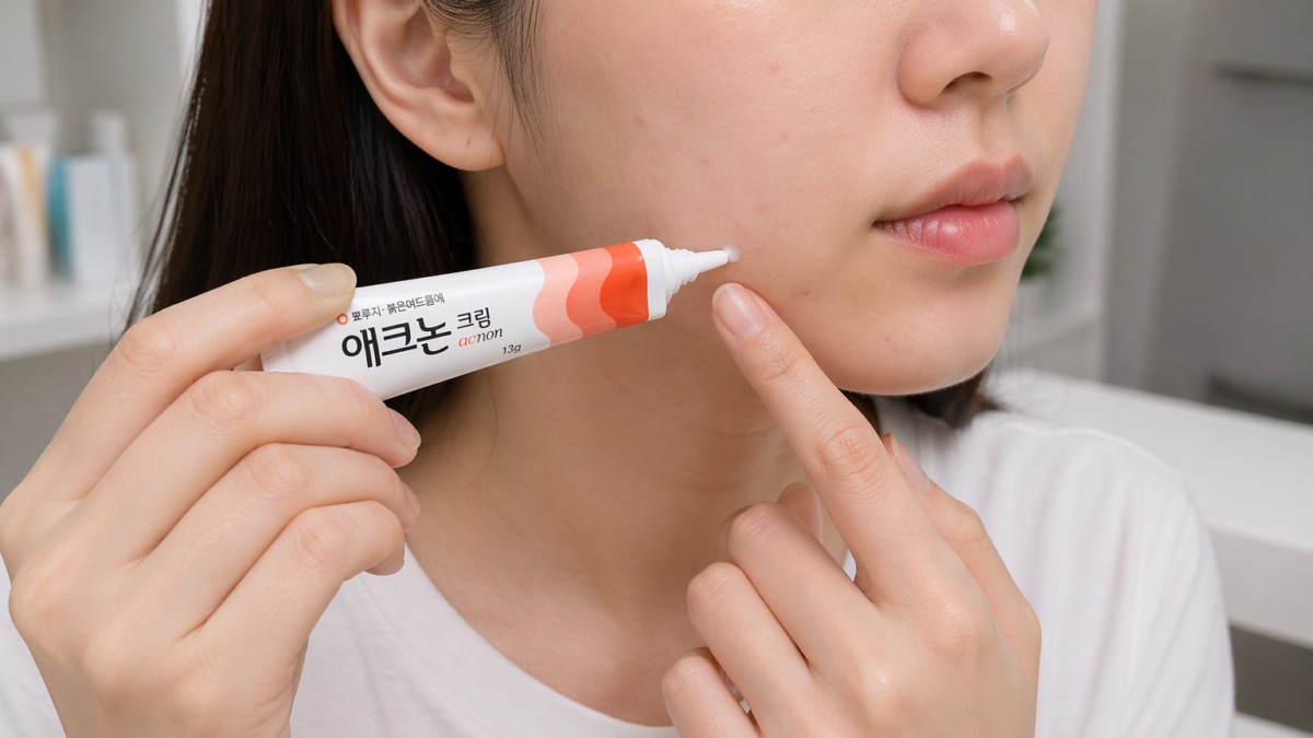 여드름 연고